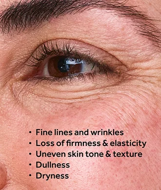 Fine lines and Wrinkles, loss of firmness & elasticity, uneven skin tone & texture, dullness, dryness. Explore our Future Renew range