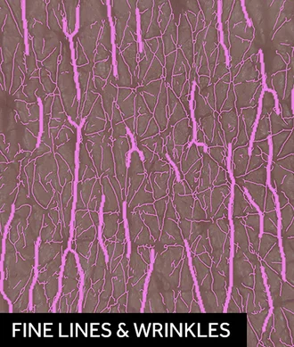 Fine Lines and Wrinkles