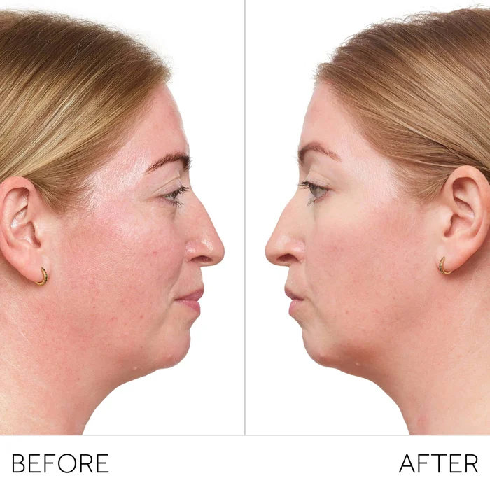 Visible results
