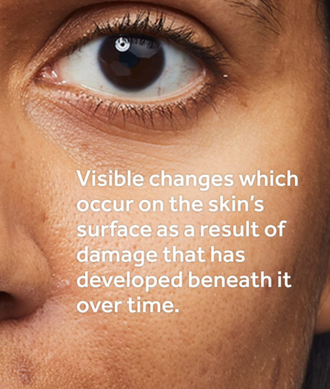 Visible changes which occur on the skin's surface as a result of damage that has developed beneath it. Explore our Future Renew range.